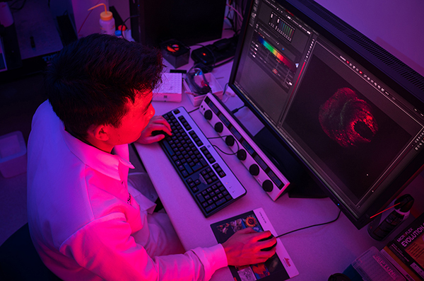 Imaging biomarkers from AI federated learning